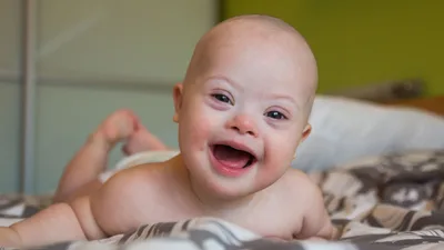 Pro-Life Congresswoman Rebuts 'I Would've Aborted a Fetus with Down Syndrome' Op-Ed
