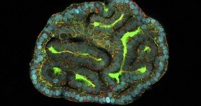 Scientists Grow Mini Organs from Cells in Amniotic Fluid
