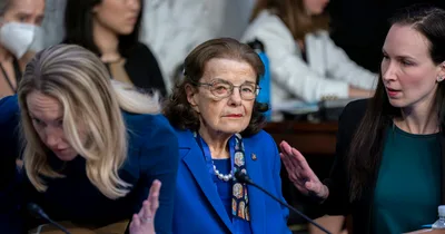 Feinstein suffers from Ramsay Hunt syndrome