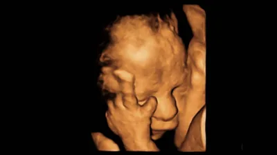Bill Allowing Minors to Get Abortion Without Parental Consent Passes in Illinois