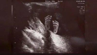 'Protecting Pain-Capable Unborn Children': Sen. Graham Introduces Bill to Protect Babies from Late-Term Abortions