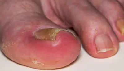 A toe, a tooth, and the theology of perspective
