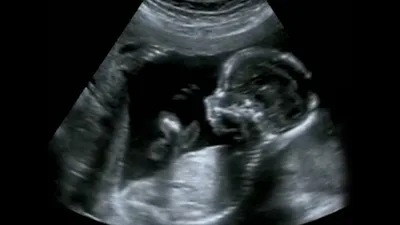 'Short Window of Time': Texas Abortion Ban Forces Pregnancy Centers to Quickly Pivot