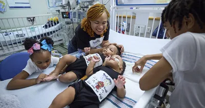 Couple chooses life, take home formerly conjoined twins