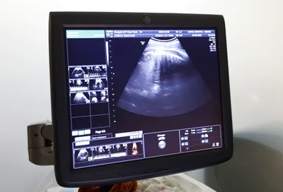 Roe v. Wade: Unscientific and outdated