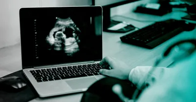 Fertility Treatment Beyond the Quick Fix