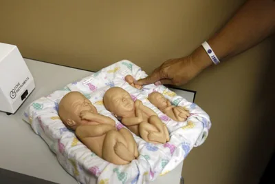 Indiana Can Require Abortion Clinics to Cremate or Bury Aborted Babies, 7th Circuit Rules