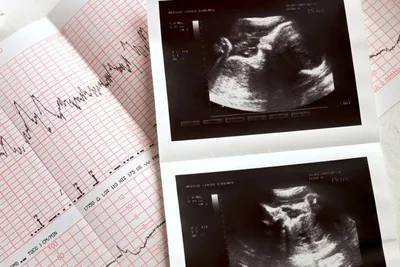 Pro-life leaders applaud Texas Supreme Court ruling upholding Heartbeat Act