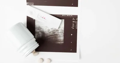 Study: Doctors don’t screen for abortion coercion — and it hurts women