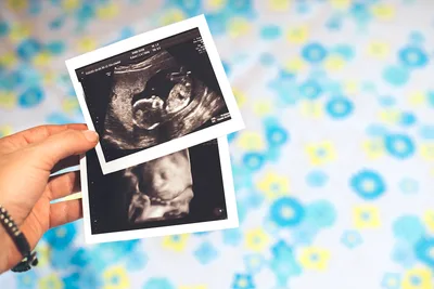 Puerto Rico Gives Legal Protection to Unborn Babies; Pro-Lifers Praise 'historic moment'