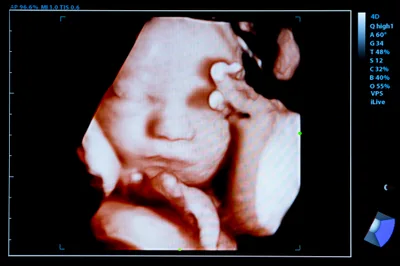 Illinois General Assembly repeals parental notification | Baptist Press