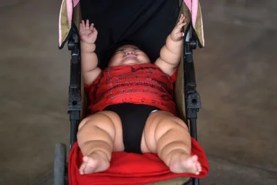 Severe Obesity Growing in American Children under 5 is ‘nearly irreversible’: Study
