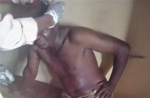 Muslim Brother of Christian Attacks Him with Machete - Morningstar News
