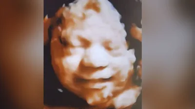 'Win for the Unborn!' Appeals Court Dismisses Final Challenge Against Texas Heartbeat Act