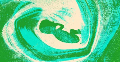 Sanctity of Life Does Not Depend on Quality of Life