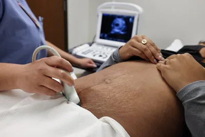 Appeals court sends challenge to Texas abortion law to state Supreme Court