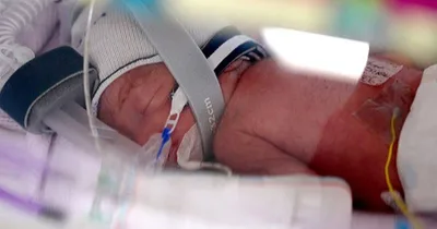 Rare set of identical quadruplet girls born in Australia