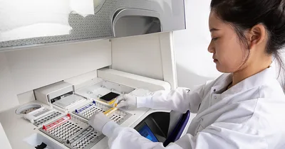 Two in five adult cancer cases preventable, U.S. study finds