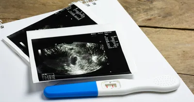 Iowa Supreme Court Protects Unborn Life