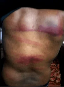 Christians Tortured, Forced to Recite Islamic Creed in Pakistan - Morningstar News