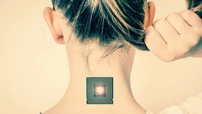 You May Not Get Microchipped, but Experts Say Your Kids Will