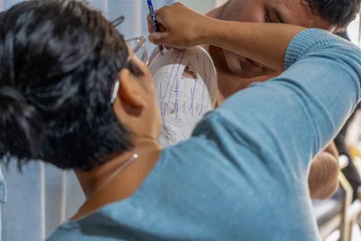 Prosthetics Ministry Opens Gospel Doors in East Asia | Baptist Press
