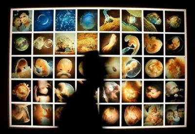 5 'gruesome and unethical' abortion clinic practices for disposing of aborted baby body parts