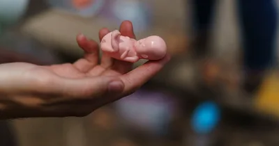 Report: abortions increase since 2017