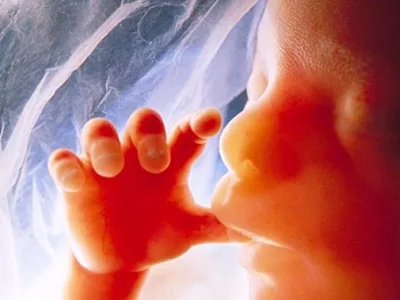 Personhood Rights Extend to Unborn Baby Killed in Pregnant Mom's Murder: Mass. Supreme Court