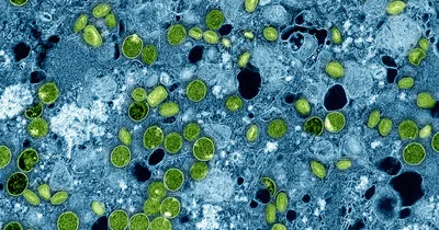 African Leaders Fighting Rising Mpox Cases