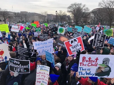 Over 42.6M abortions conducted in 2020, surpassing world's leading causes of death