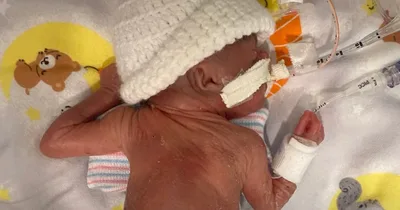 Baby Had Virtually No Chance of Survival — Then the Record-Breaking Preemie Shocked Doctors and 'Defied All Scientific Odds'