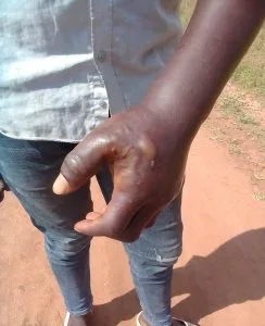 Evangelist, other Christians in Uganda Assaulted - Morningstar News