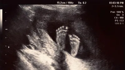 VA Lawmakers Aim to Protect Unborn Babies From Painful Abortions After 15 Weeks