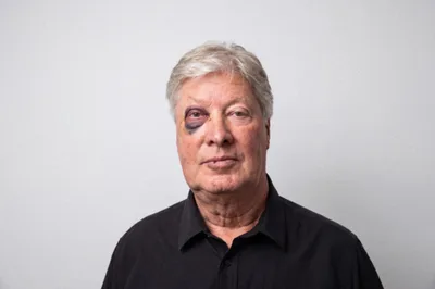 Former Gateway Pastor Robert Morris’ Sex Offender Registry Photo Shows a Black Eye - RELEVANT