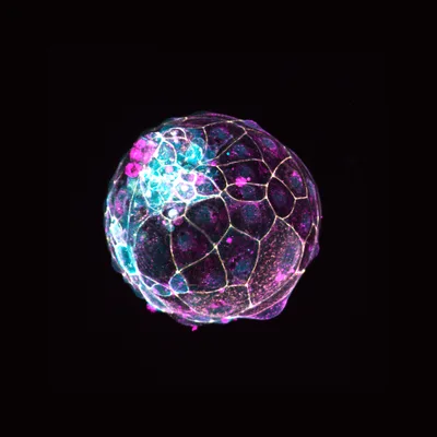 Scientists use stem cells to create models of pre-embryos