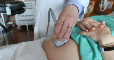 Contagious yawning may start in the womb, study says