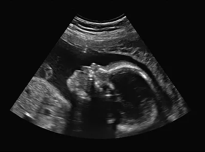 ERLC’s Psalm 139 Project places 100th ultrasound machine | Baptist Press