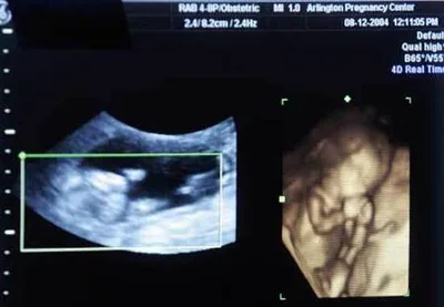 Judge Rules Life Beginning at Conception is a ‘distinctly Christian’ Idea, Blocks Kentucky Abortion Ban