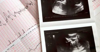 Study: Texas fertility rate rose after ‘Heartbeat Act’