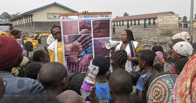 With over 500 dead, UN declares monkeypox emergency