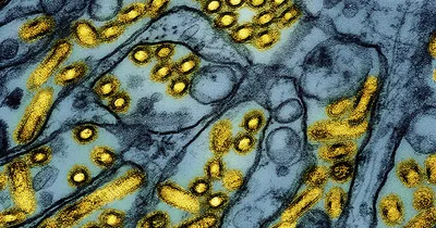 Health Officials Report First Human Bird Flu Death in U.S.